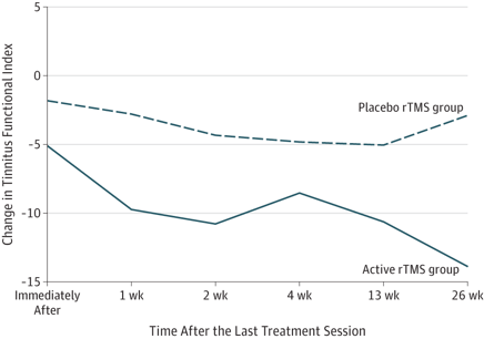 TMS Tinnitus therapy chart